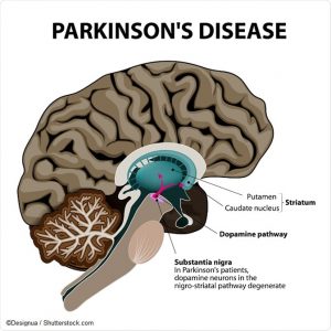 Dia Mundial contra la enfermerdad de Parkinson