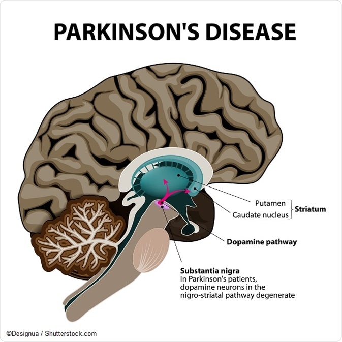 Dia Mundial contra la Malaltia de Parkinson